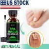 Anti-fungal Treatment Extra Strength (Toenail Fungus & Athlete's Foot)