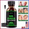 Anti-fungal Treatment Extra Strength (Toenail Fungus & Athlete's Foot)