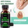 Anti-fungal Treatment Extra Strength (Toenail Fungus & Athlete's Foot)