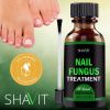 Anti-fungal Treatment Extra Strength (Toenail Fungus & Athlete's Foot)