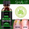 Anti-fungal Treatment Extra Strength (Toenail Fungus & Athlete's Foot)