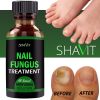 Anti-fungal Treatment Extra Strength (Toenail Fungus & Athlete's Foot)