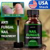 Anti-fungal Treatment Extra Strength (Toenail Fungus & Athlete's Foot)